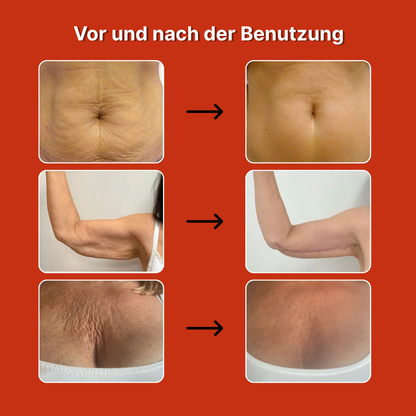 Anti-Cellulite-Magic-Öl 100 ml